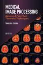Couverture de l'ouvrage Medical Image Processing