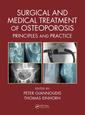 Couverture de l'ouvrage Surgical and Medical Treatment of Osteoporosis