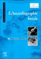 Couverture de l'ouvrage Echocardiographie foetale