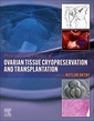 Couverture de l'ouvrage Principles and Practice of Ovarian Tissue Cryopreservation and Transplantation