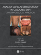 Couverture de l'ouvrage Atlas of Clinical Dermatology in Coloured Skin
