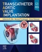 Couverture de l'ouvrage Transcatheter Aortic Valve Implantation