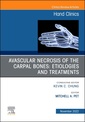Couverture de l'ouvrage Avascular Necrosis of the Carpal Bones: Etiologies and Treatments, An Issue of Hand Clinics