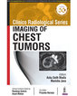 Couverture de l'ouvrage Clinico Radiological Series: Imaging of Chest Tumors