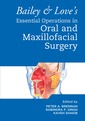 Couverture de l'ouvrage Bailey & Love's Essential Operations in Oral & Maxillofacial Surgery