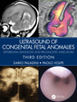 Couverture de l'ouvrage Ultrasound of Congenital Fetal Anomalies