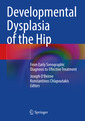 Couverture de l'ouvrage Developmental Dysplasia of the Hip