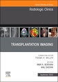 Couverture de l'ouvrage Solid organ transplantation imaging, An Issue of Radiologic Clinics of North America