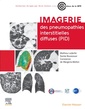 Couverture de l'ouvrage Imagerie des pneumopathies interstitielles diffuses (PID)