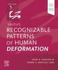 Couverture de l'ouvrage Smith's Recognizable Patterns of Human Deformation