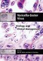Couverture de l'ouvrage Varicella-Zoster virus :virology and clinical management