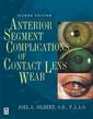 Couverture de l'ouvrage Anterior segment complications of contact lens wear 2nd Ed. 2000