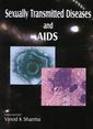 Couverture de l'ouvrage Sexually Transmitted Diseases and AIDS